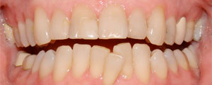 Otho Before