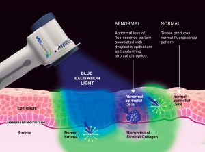 Velscope mechanism of action