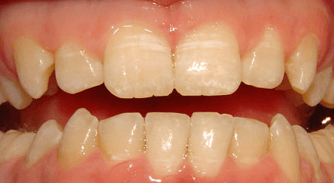 Female dental professional talking with patient