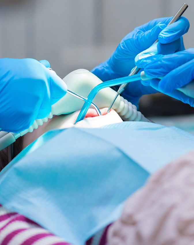 Dental procedure close-up using mirror and suction