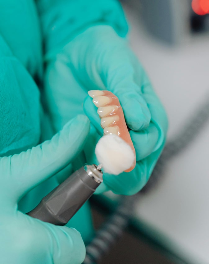 Dental impression tray being prepared
