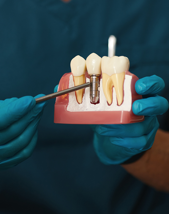 Dental instruments displayed vertically