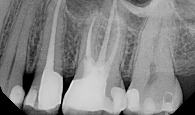 Dental radiograph showing tooth roots