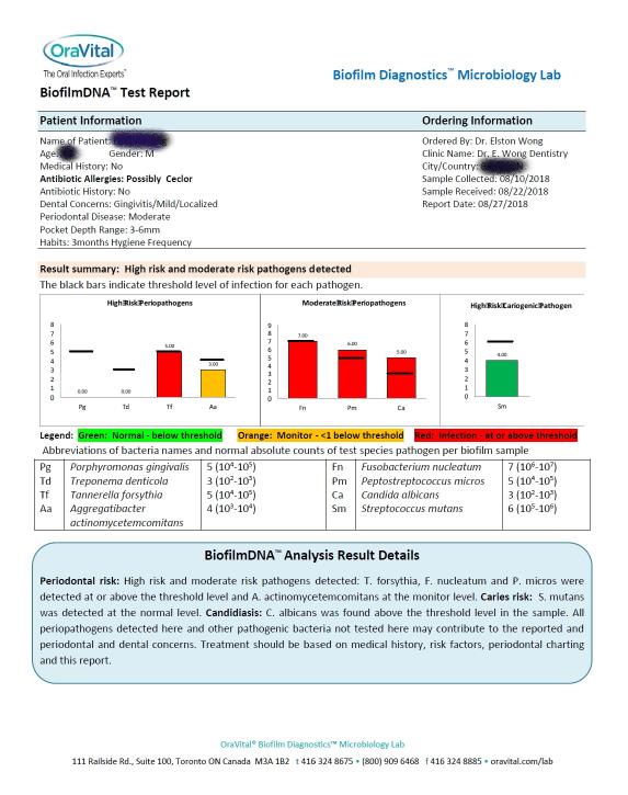 Dental report and oral health analysis chart for patient evaluation
