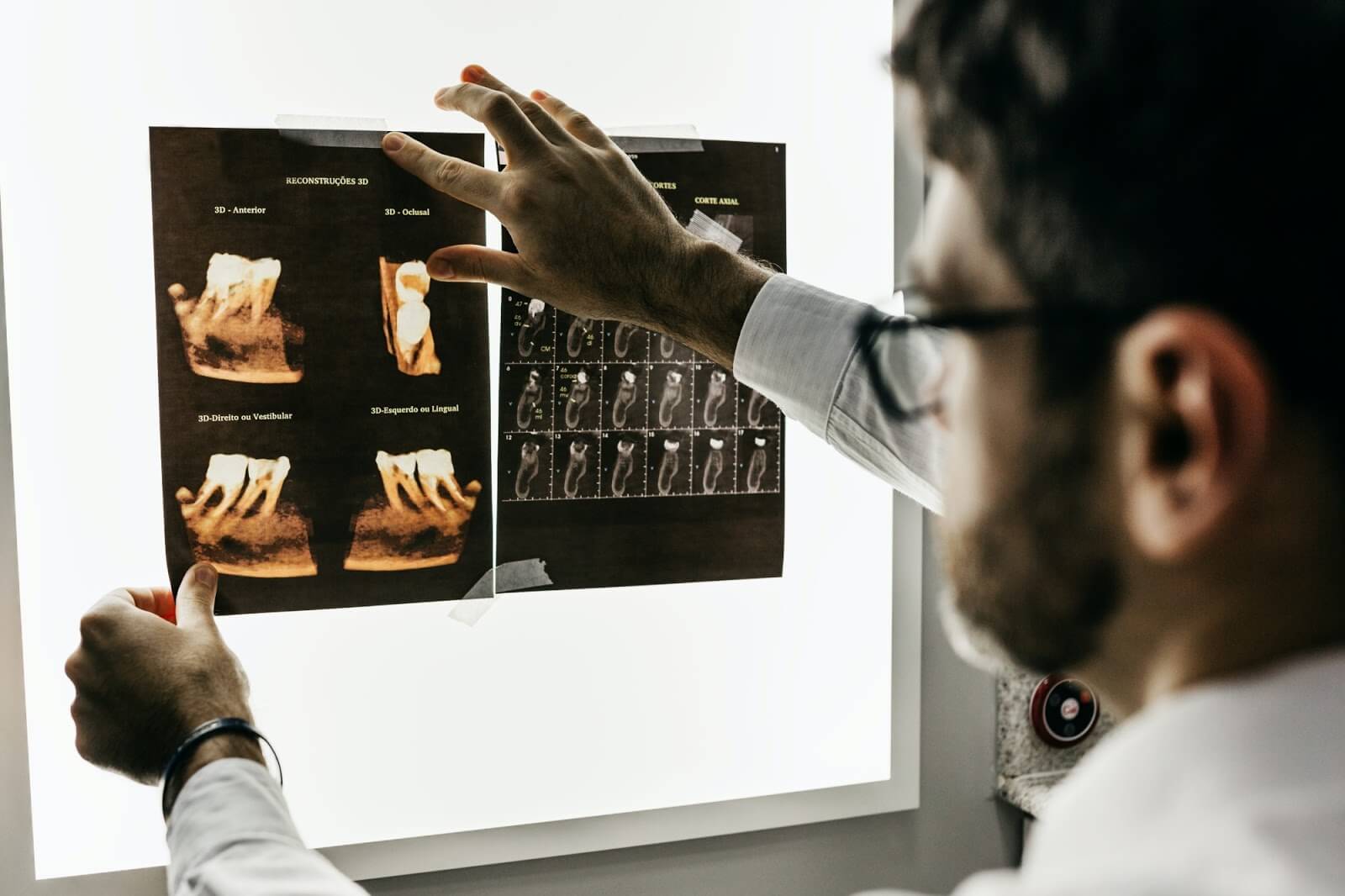 a male dentist looking at x-rays of teeth